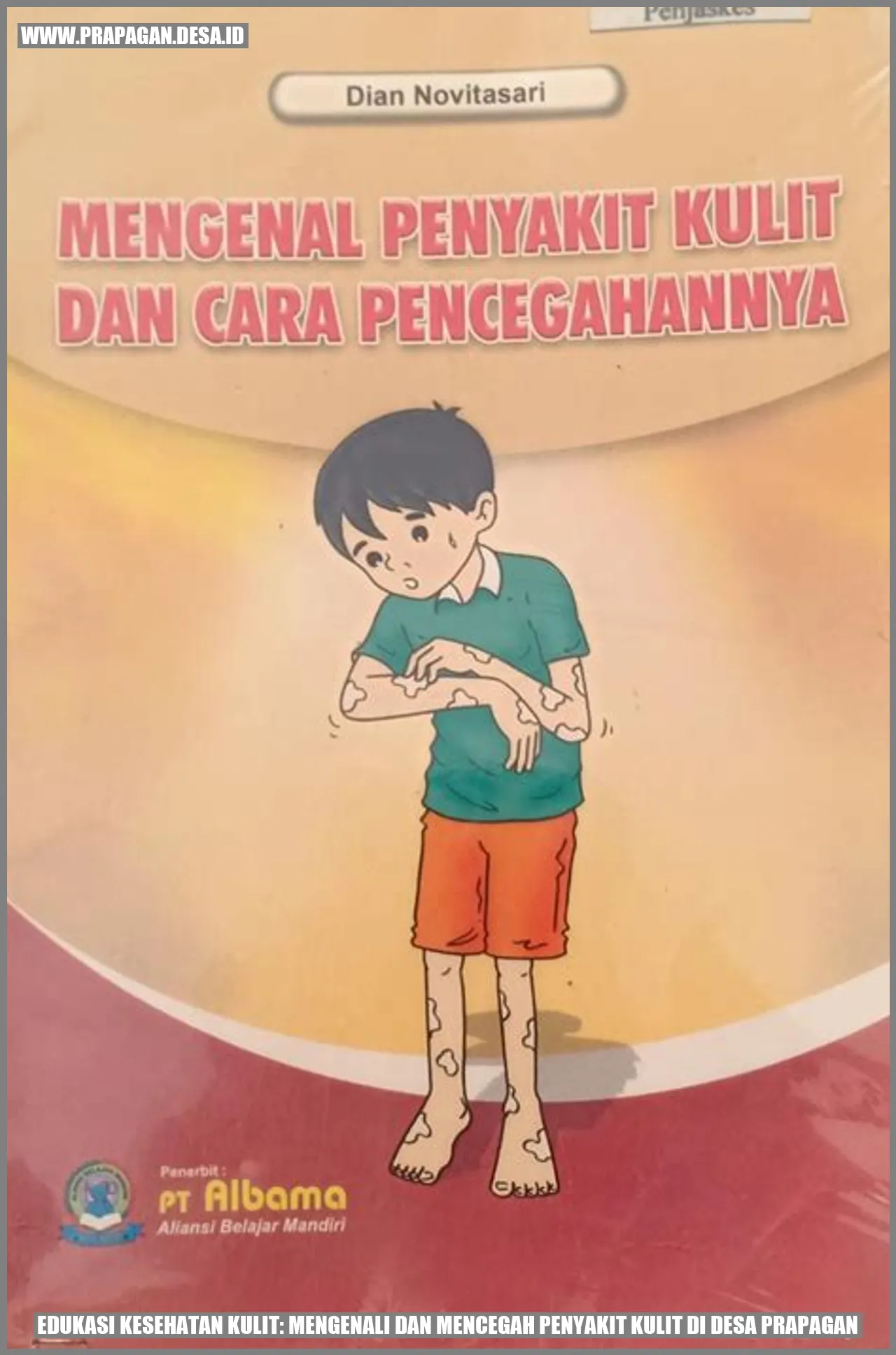 Edukasi Kesehatan Kulit: Mengenali dan Mencegah Penyakit Kulit di Desa prapagan