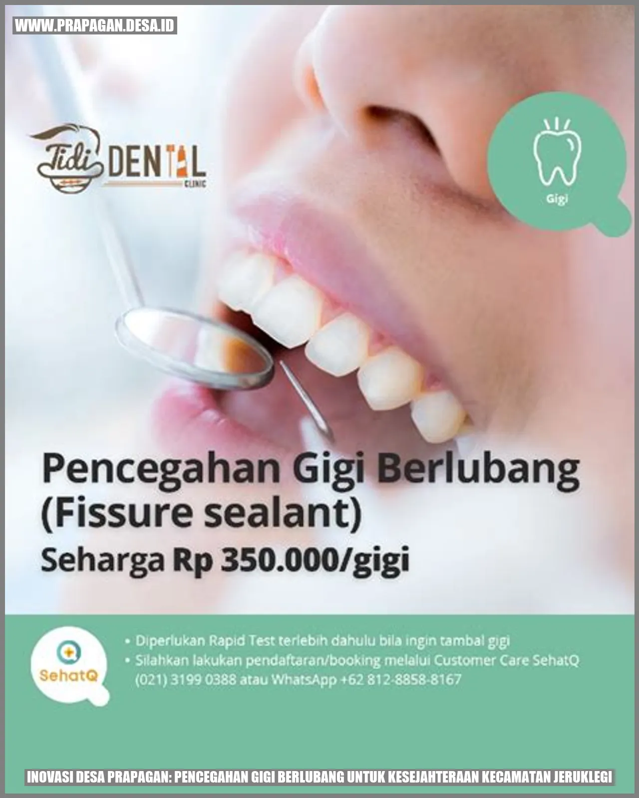 Inovasi Desa prapagan: Pencegahan Gigi Berlubang untuk Kesejahteraan Kecamatan Jeruklegi