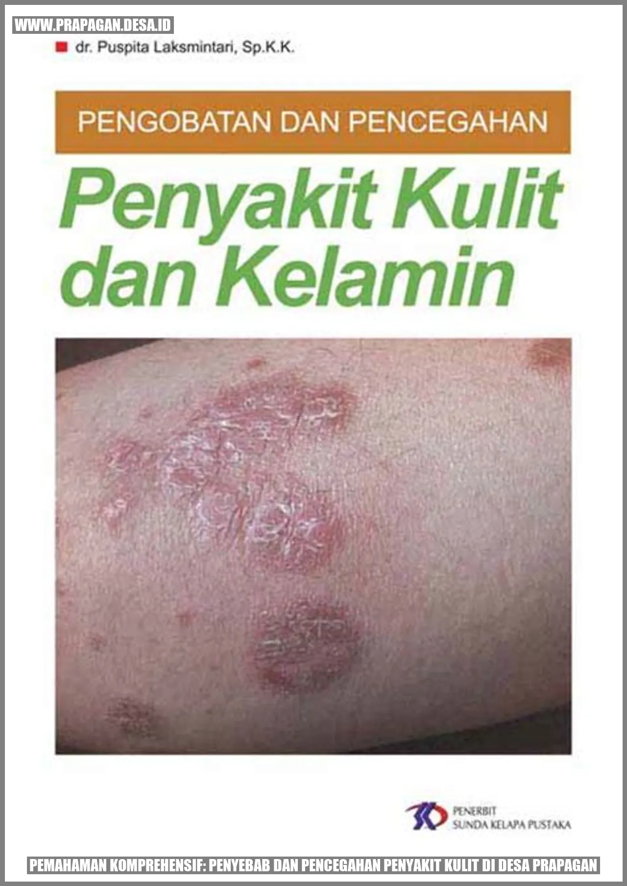 Penyakit Kulit
